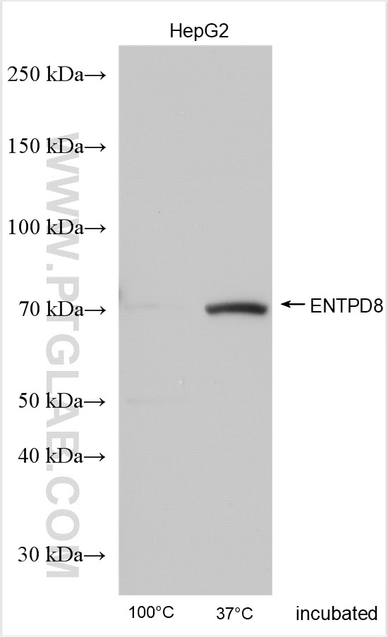 Western Blot (WB) analysis of various lysates using ENTPD8 Polyclonal antibody (21010-1-AP)