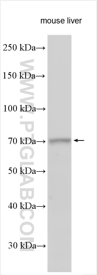 Western Blot (WB) analysis of various lysates using ENTPD8 Polyclonal antibody (21010-1-AP)