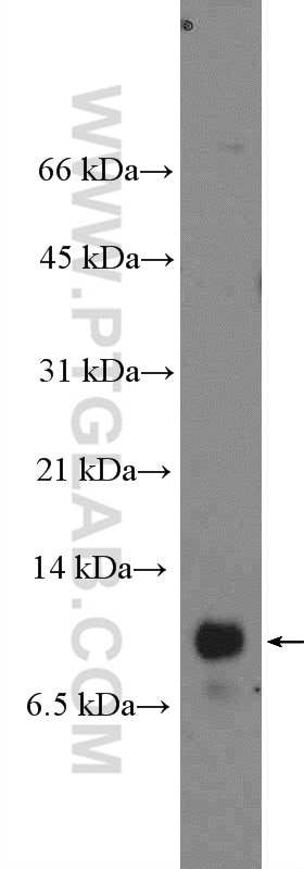 Western Blot (WB) analysis of PC-3 cells using ENY2 Polyclonal antibody (15778-1-AP)