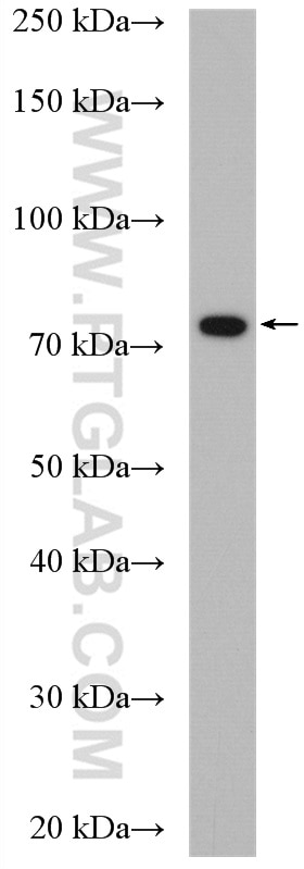 Western Blot (WB) analysis of mouse brain tissue using EOMES/TBR2 Polyclonal antibody (28316-1-AP)