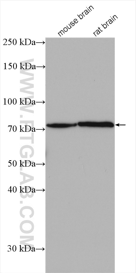 Western Blot (WB) analysis of various lysates using EOMES/TBR2 Polyclonal antibody (28316-1-AP)