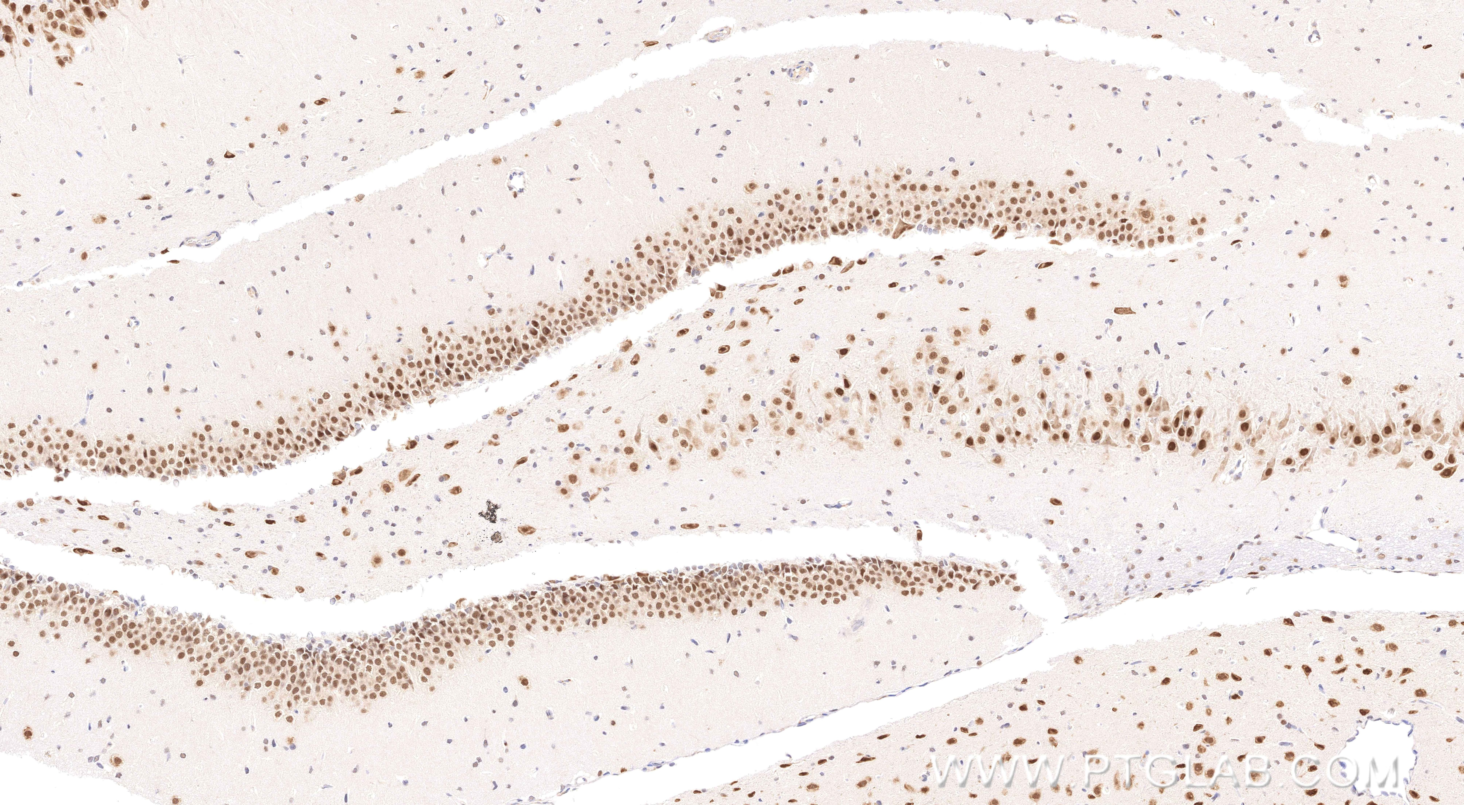 Immunohistochemistry (IHC) staining of rat brain tissue using EOMES/TBR2 Recombinant monoclonal antibody, PBS On (83945-5-PBS)