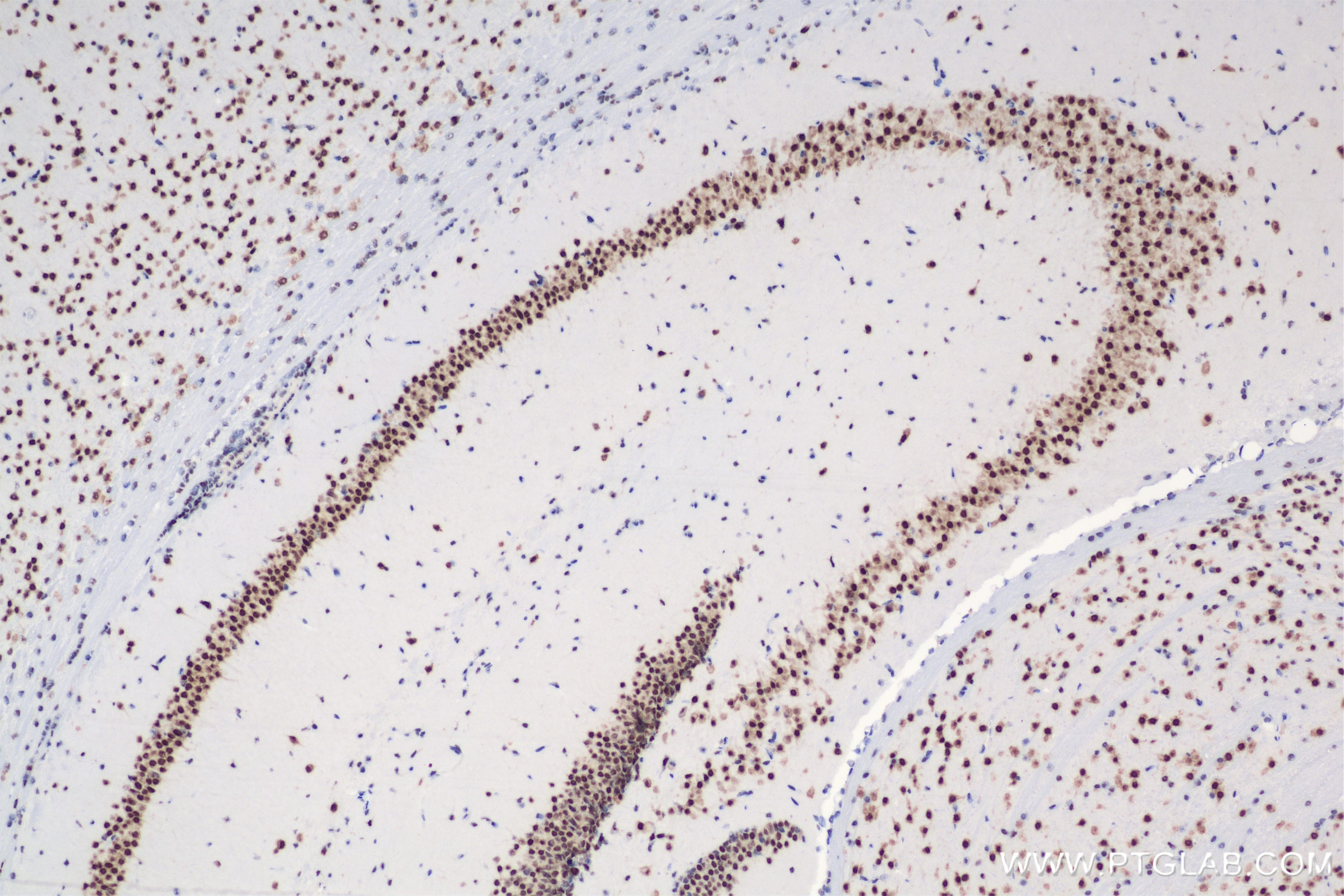 Immunohistochemistry (IHC) staining of mouse brain tissue using EOMES/TBR2 Recombinant antibody (83945-5-RR)