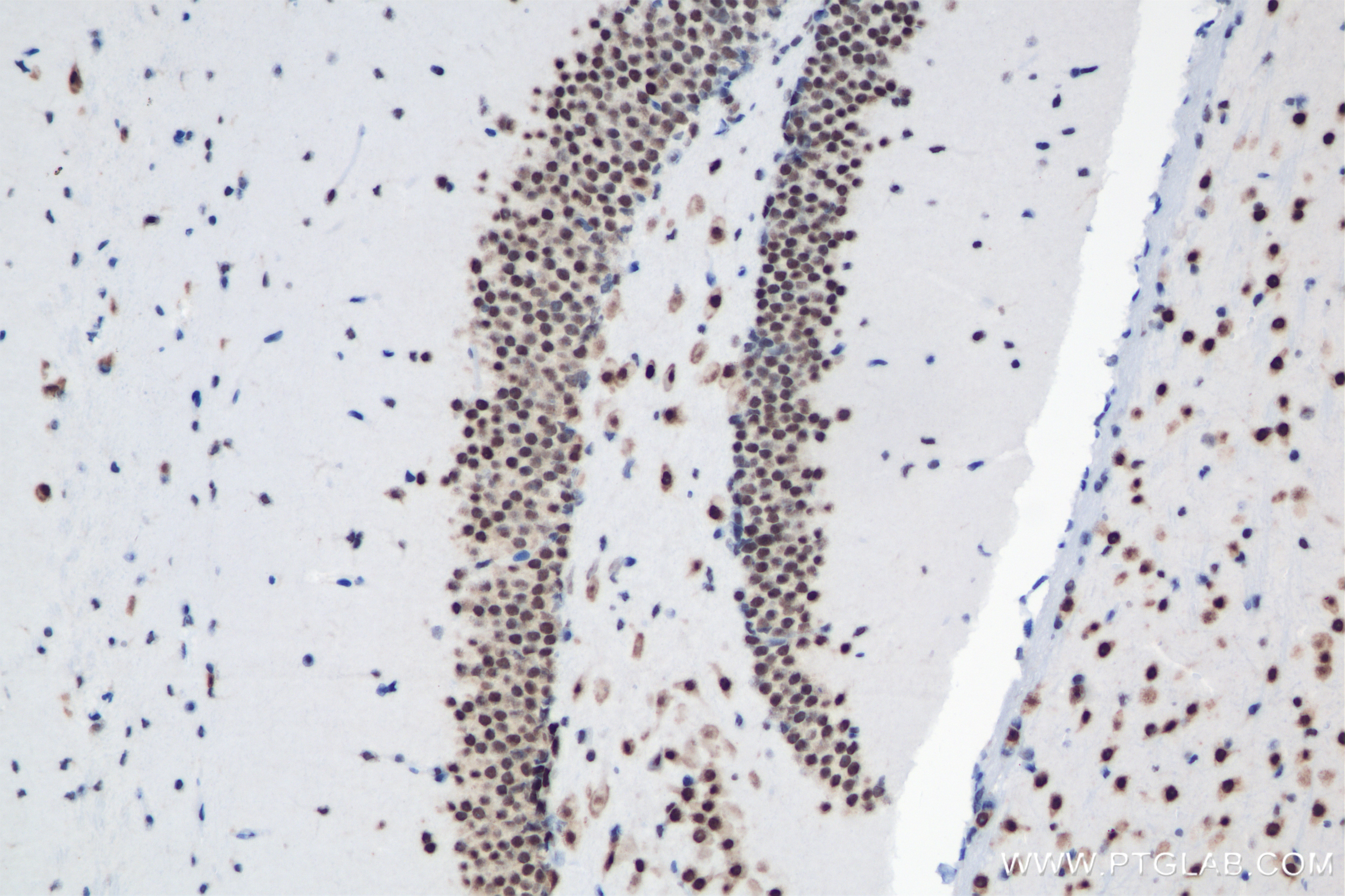 Immunohistochemistry (IHC) staining of mouse brain tissue using EOMES/TBR2 Recombinant antibody (83945-5-RR)