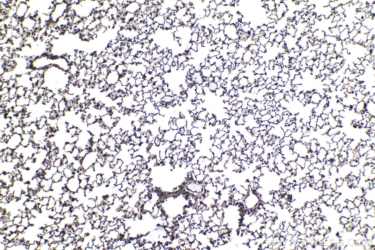 Immunohistochemistry (IHC) staining of mouse lung tissue using p300 Polyclonal antibody (20695-1-AP)