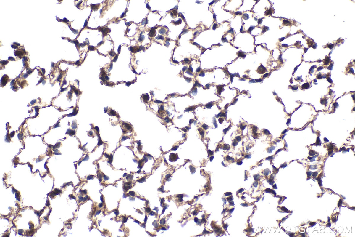 Immunohistochemistry (IHC) staining of mouse lung tissue using p300 Polyclonal antibody (20695-1-AP)