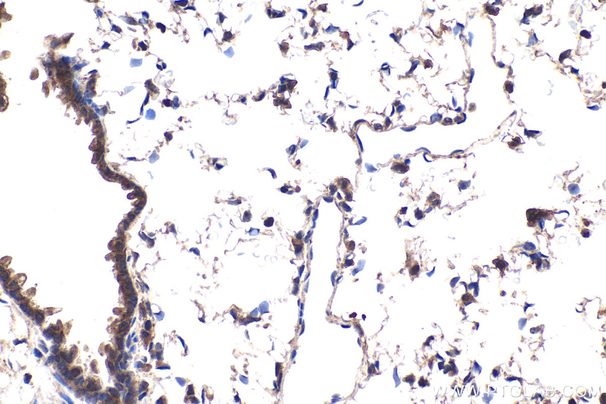 Immunohistochemistry (IHC) staining of rat lung tissue using p300 Polyclonal antibody (20695-1-AP)
