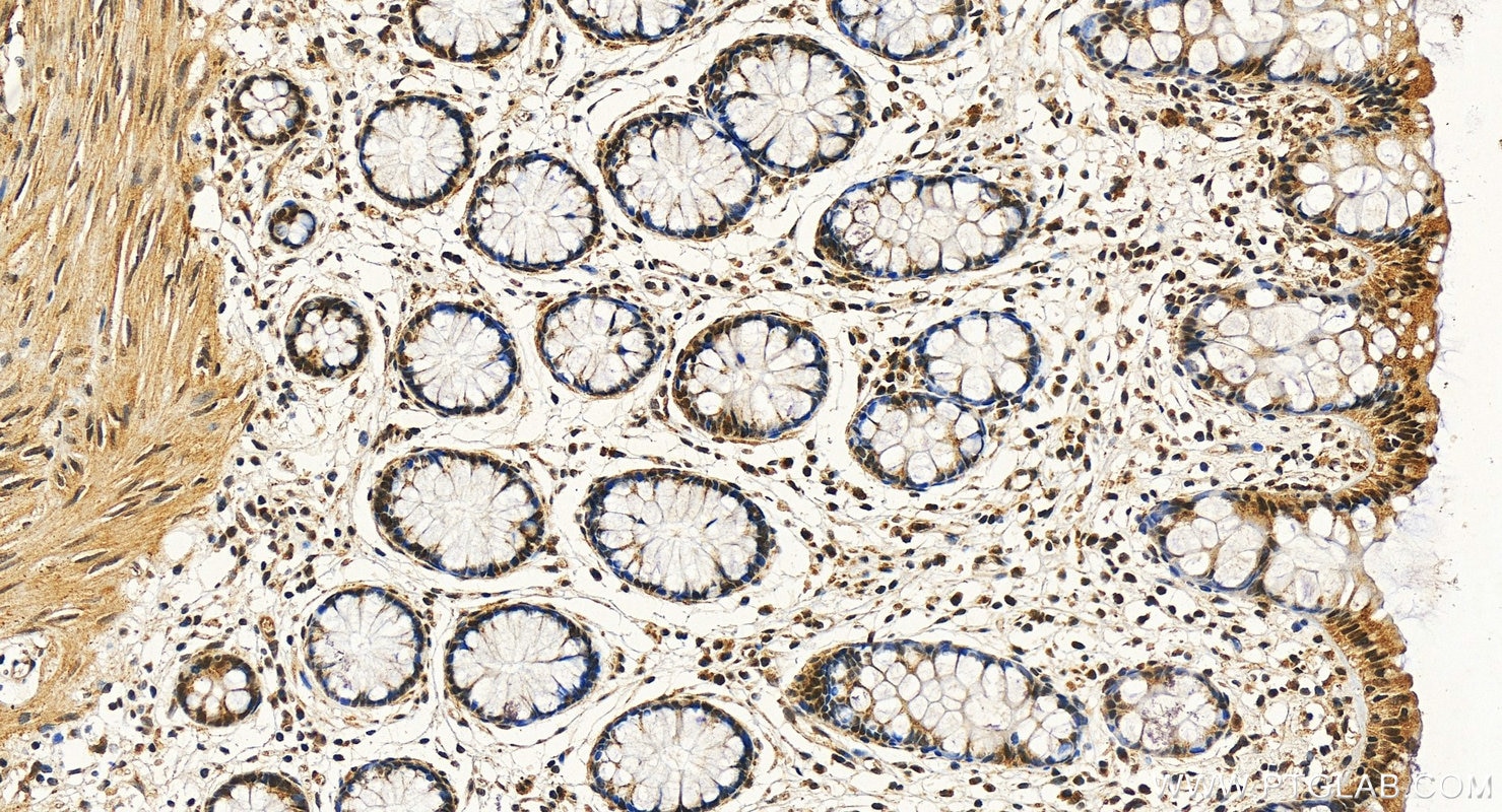 Immunohistochemistry (IHC) staining of human colon tissue using EP400 Polyclonal antibody (13858-1-AP)