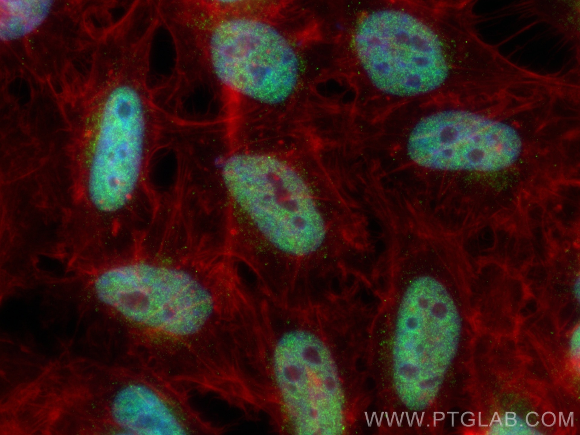 Immunofluorescence (IF) / fluorescent staining of HeLa cells using EP400 Polyclonal antibody (13858-1-AP)