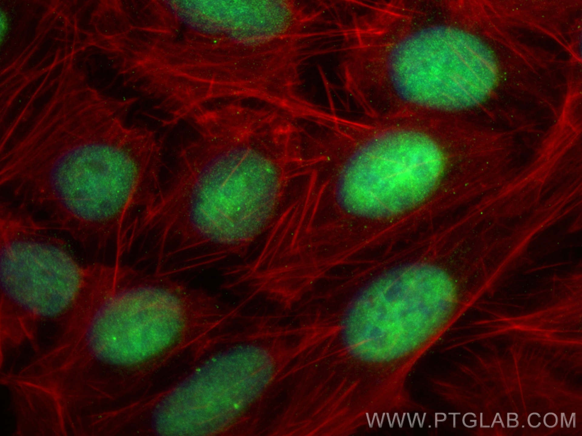 Immunofluorescence (IF) / fluorescent staining of U2OS cells using EP400 Polyclonal antibody (13858-1-AP)