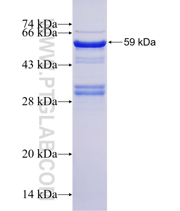 EP400 fusion protein Ag4832 SDS-PAGE