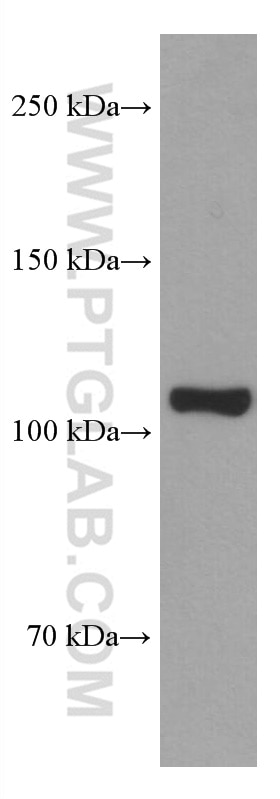 Western Blot (WB) analysis of mouse brain tissue using EPAC2 Monoclonal antibody (67044-1-Ig)