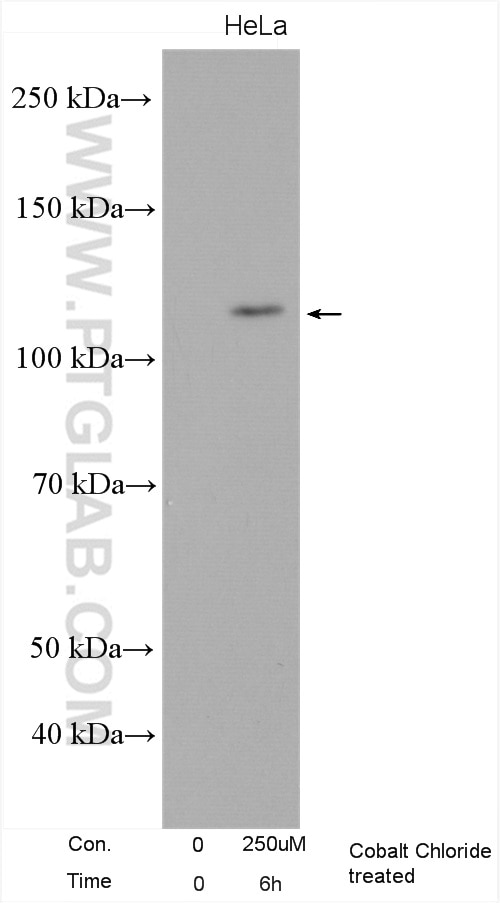 Western Blot (WB) analysis of various lysates using HIF2α/EPAS1 Polyclonal antibody (26422-1-AP)