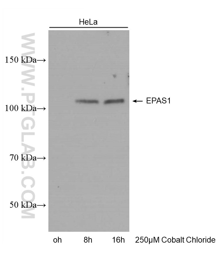 Western Blot (WB) analysis of HeLa cells using HIF2α/EPAS1 Monoclonal antibody (66731-1-Ig)