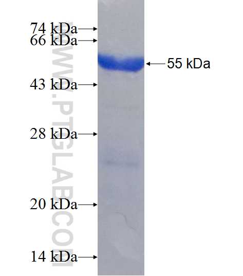 EPAS1 fusion protein Ag24886 SDS-PAGE