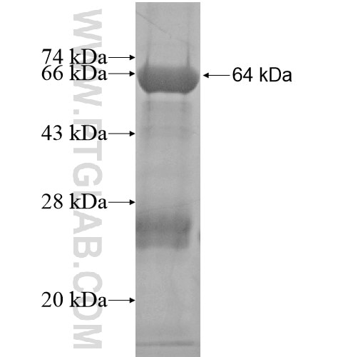 EPAS1 fusion protein Ag15199 SDS-PAGE