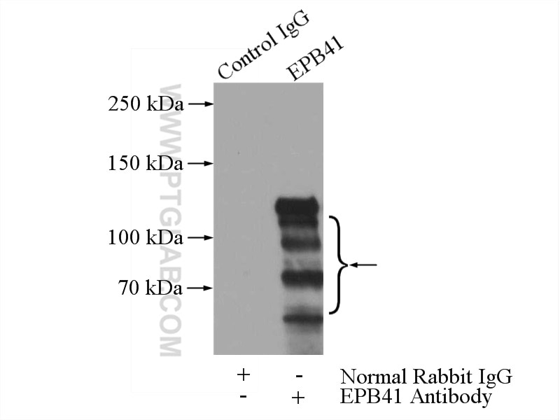 Immunoprecipitation (IP) experiment of HL-60 cells using EPB41 Polyclonal antibody (13014-1-AP)