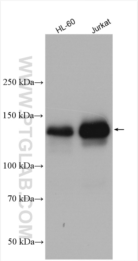 Western Blot (WB) analysis of various lysates using EPB41 Polyclonal antibody (13014-1-AP)