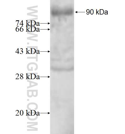 EPB41 fusion protein Ag4075 SDS-PAGE