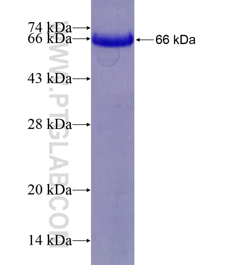 EPB41 fusion protein Ag4365 SDS-PAGE