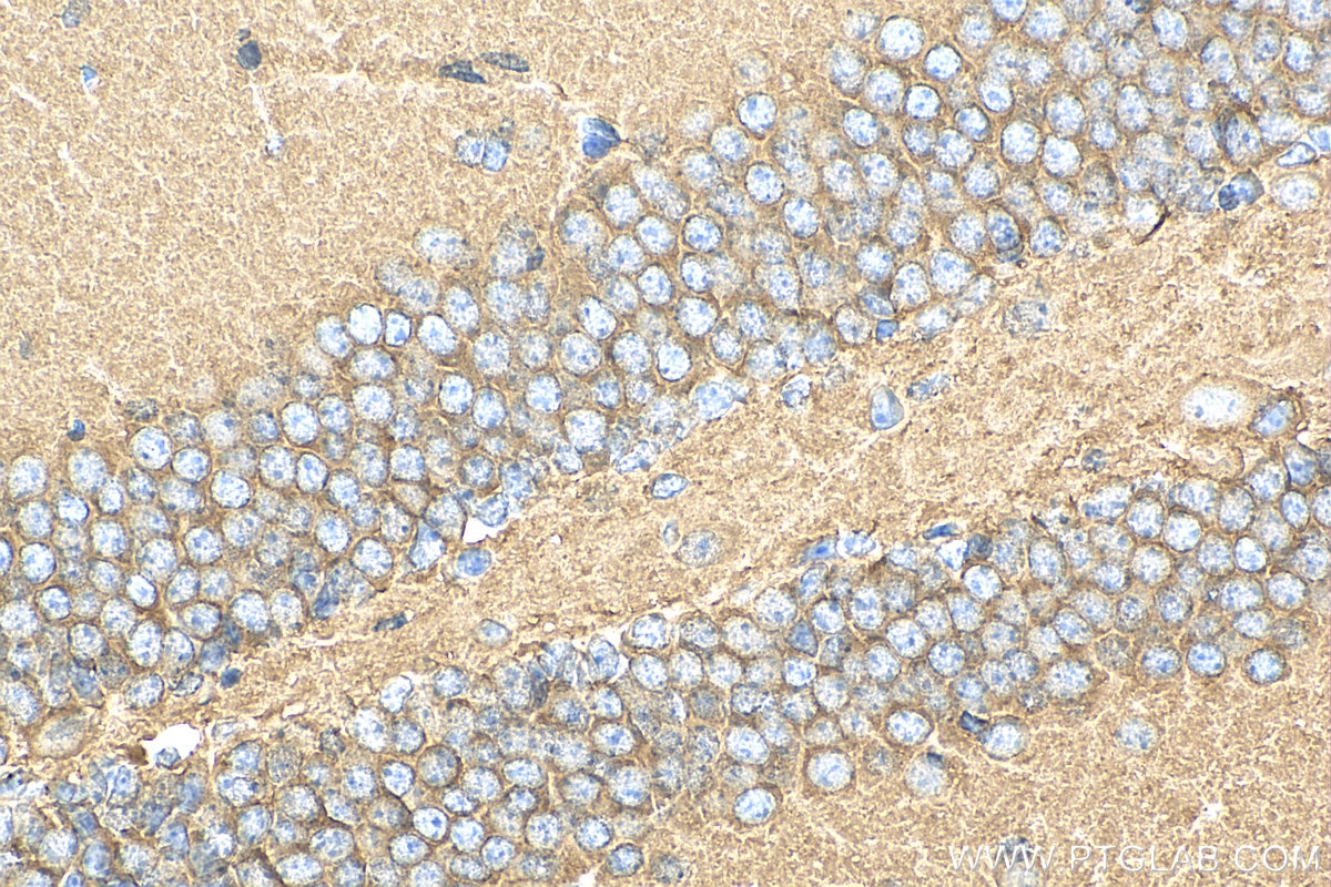 Immunohistochemistry (IHC) staining of mouse brain tissue using EPB41L1 Polyclonal antibody (13440-1-AP)