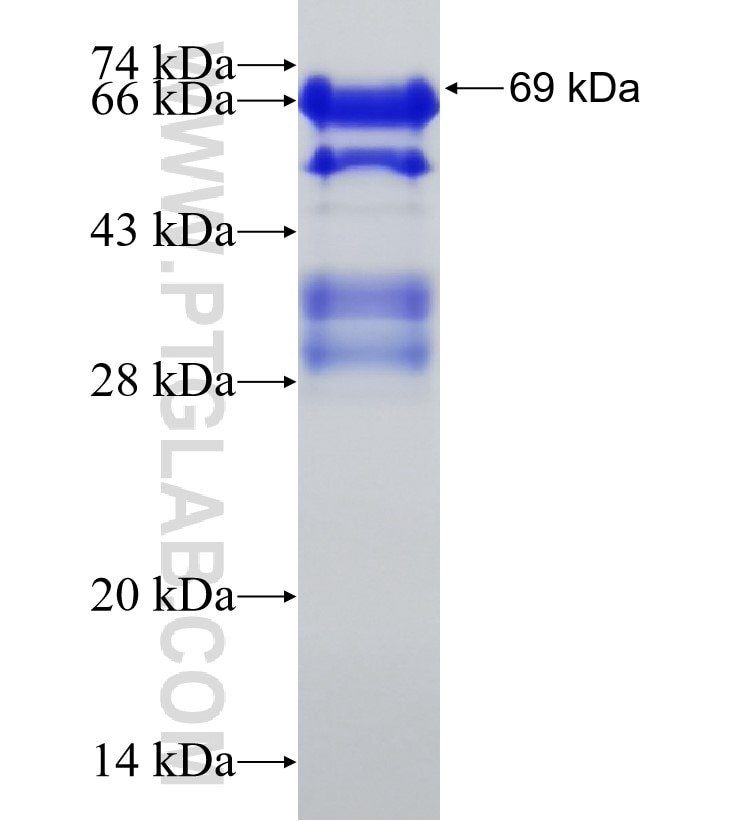 EPB41L1 fusion protein Ag4250 SDS-PAGE