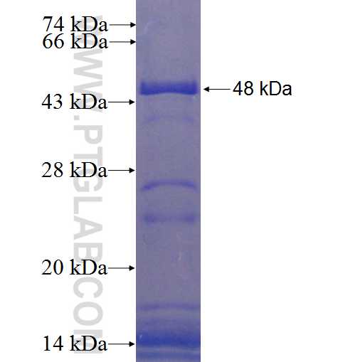 EPB41L1 fusion protein Ag6847 SDS-PAGE