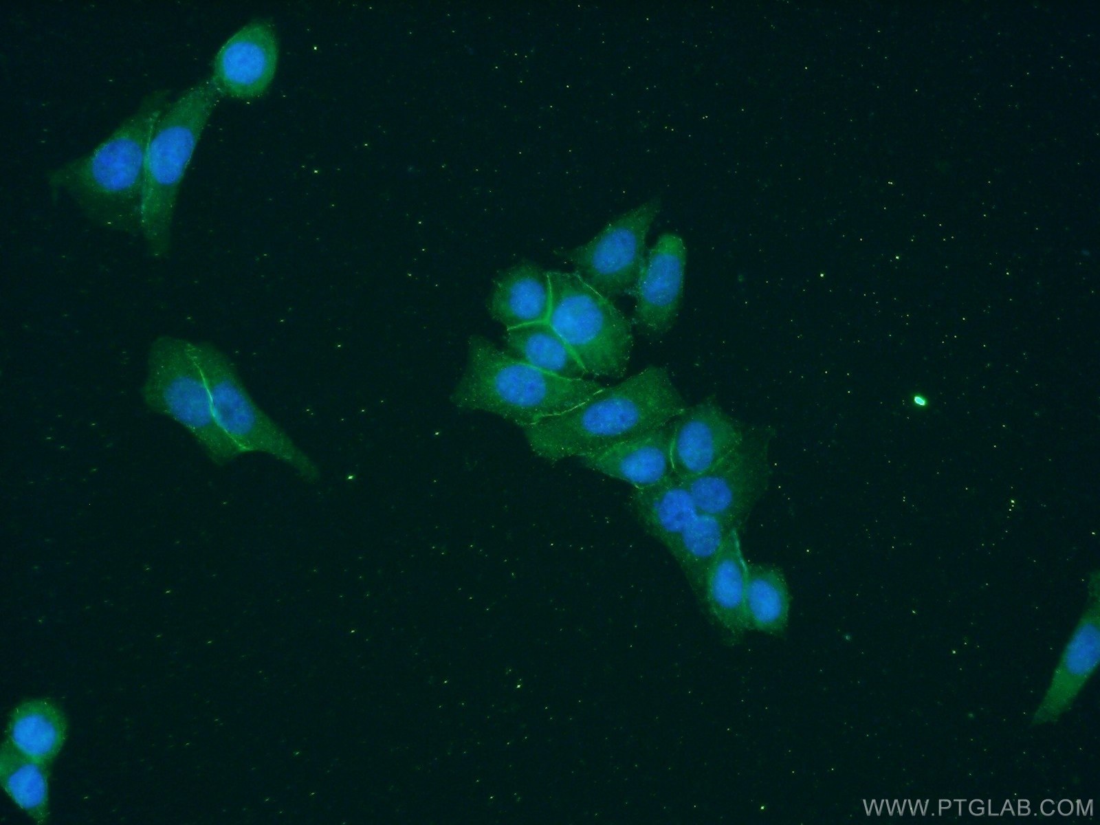 Immunofluorescence (IF) / fluorescent staining of HeLa cells using EPB41L2 Polyclonal antibody (15437-1-AP)