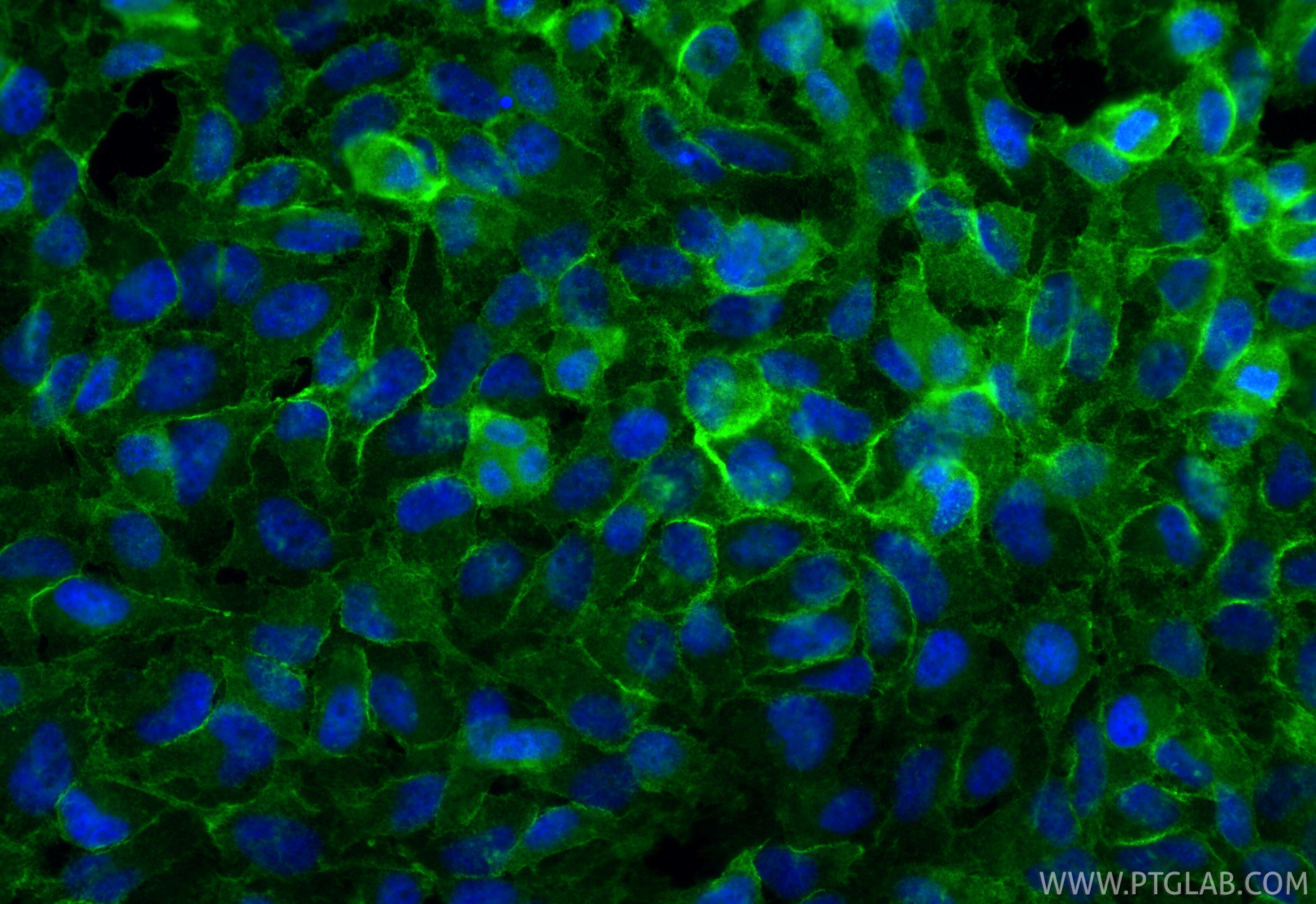 Immunofluorescence (IF) / fluorescent staining of HeLa cells using EPB41L2 Polyclonal antibody (15437-1-AP)