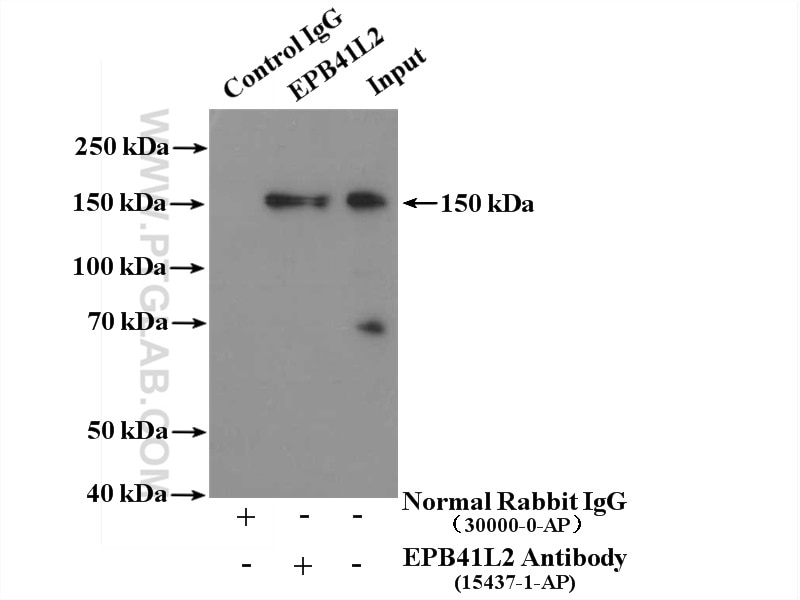 Immunoprecipitation (IP) experiment of HEK-293 cells using EPB41L2 Polyclonal antibody (15437-1-AP)