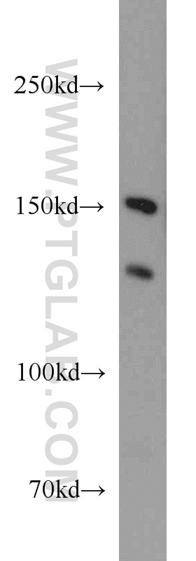 Western Blot (WB) analysis of Jurkat cells using EPB41L2 Polyclonal antibody (15437-1-AP)