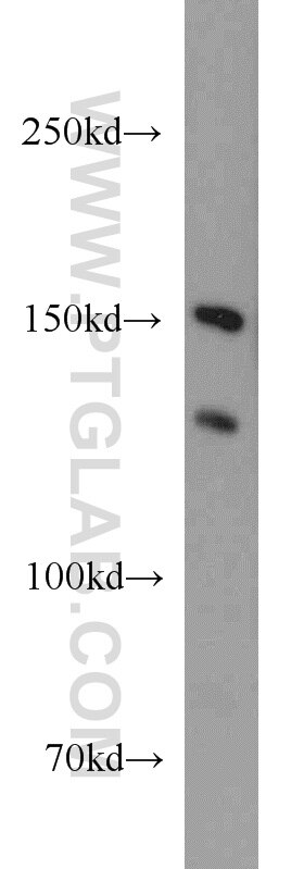 WB analysis of Jurkat using 15437-1-AP