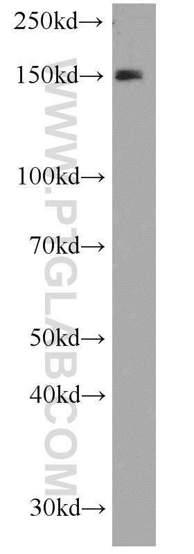 Western Blot (WB) analysis of HeLa cells using EPB41L2 Polyclonal antibody (15437-1-AP)