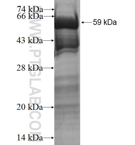 EPB41L2 fusion protein Ag3647 SDS-PAGE