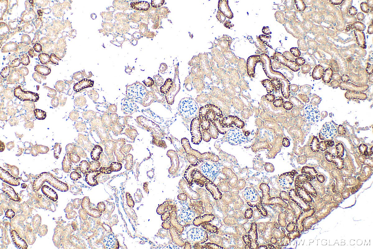Immunohistochemistry (IHC) staining of mouse kidney tissue using EPB41L3 Polyclonal antibody (10719-1-AP)