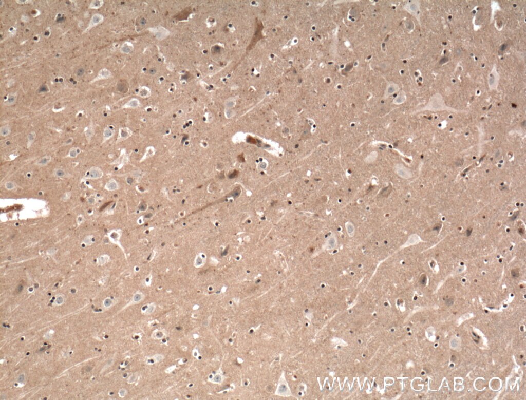 Immunohistochemistry (IHC) staining of human brain tissue using EPB41L3 Polyclonal antibody (10719-1-AP)