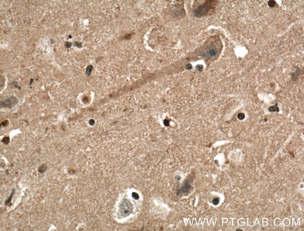 Immunohistochemistry (IHC) staining of human brain tissue using EPB41L3 Polyclonal antibody (10719-1-AP)