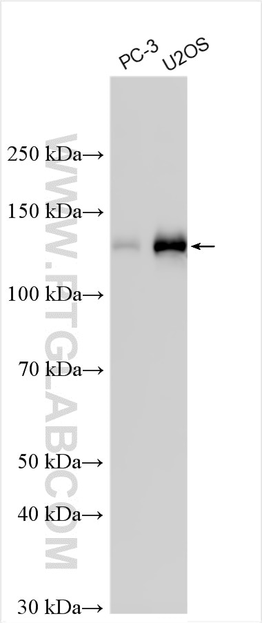 Western Blot (WB) analysis of various lysates using EPB41L3 Polyclonal antibody (10719-1-AP)