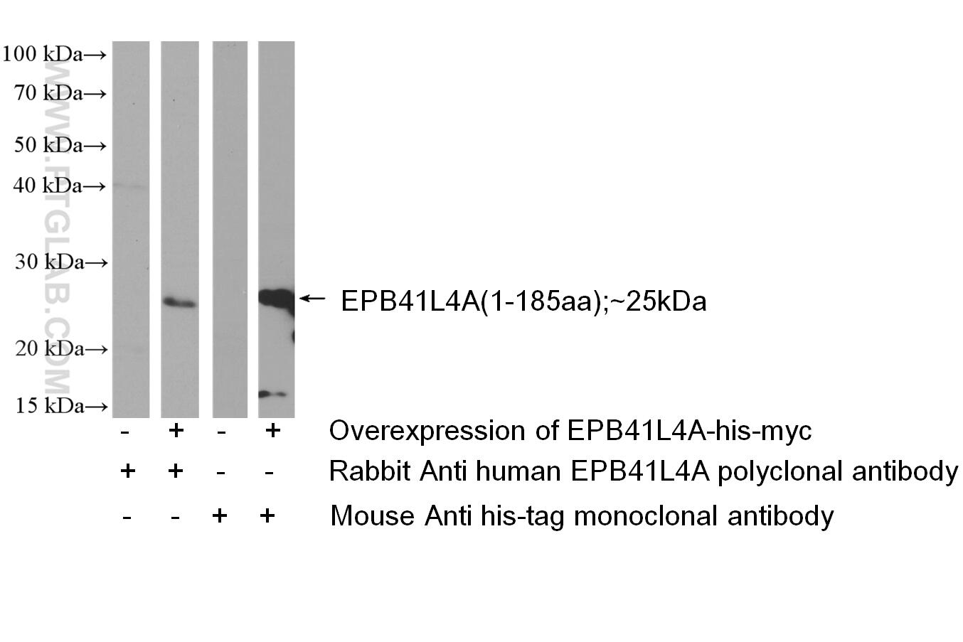 Western Blot (WB) analysis of Transfected HEK-293 cells using EPB41L4A Polyclonal antibody (26596-1-AP)