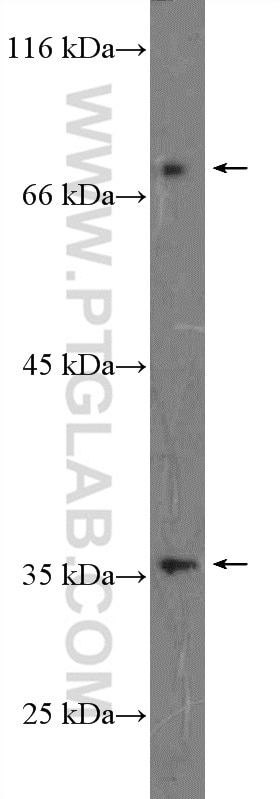 Western Blot (WB) analysis of NIH/3T3 cells using EPB41L4A Polyclonal antibody (26596-1-AP)