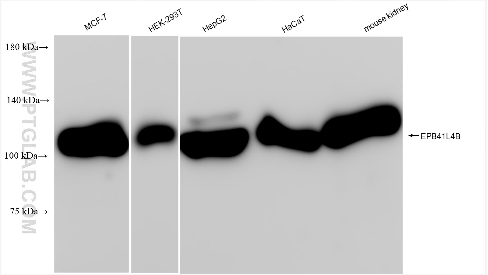 Western Blot (WB) analysis of various lysates using EPB41L4B Recombinant antibody (84732-2-RR)
