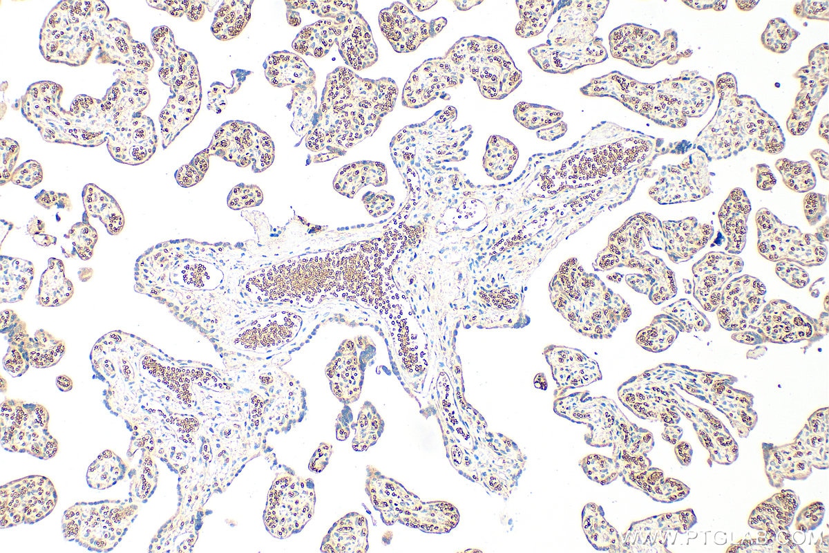 Immunohistochemistry (IHC) staining of human placenta tissue using EPB42 Polyclonal antibody (27443-1-AP)