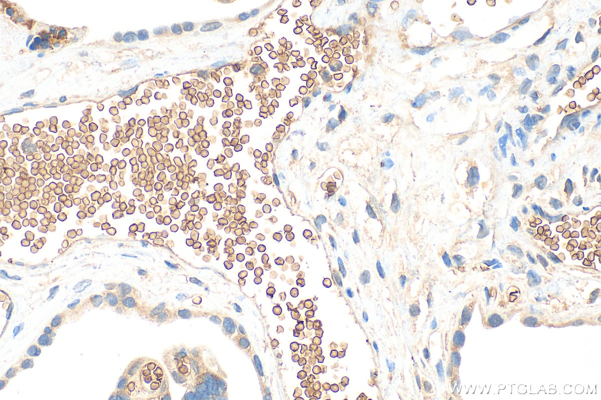 Immunohistochemistry (IHC) staining of human placenta tissue using EPB42 Polyclonal antibody (27443-1-AP)
