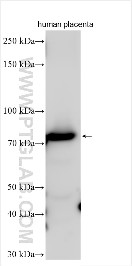 Western Blot (WB) analysis of various lysates using EPB42 Polyclonal antibody (27443-1-AP)