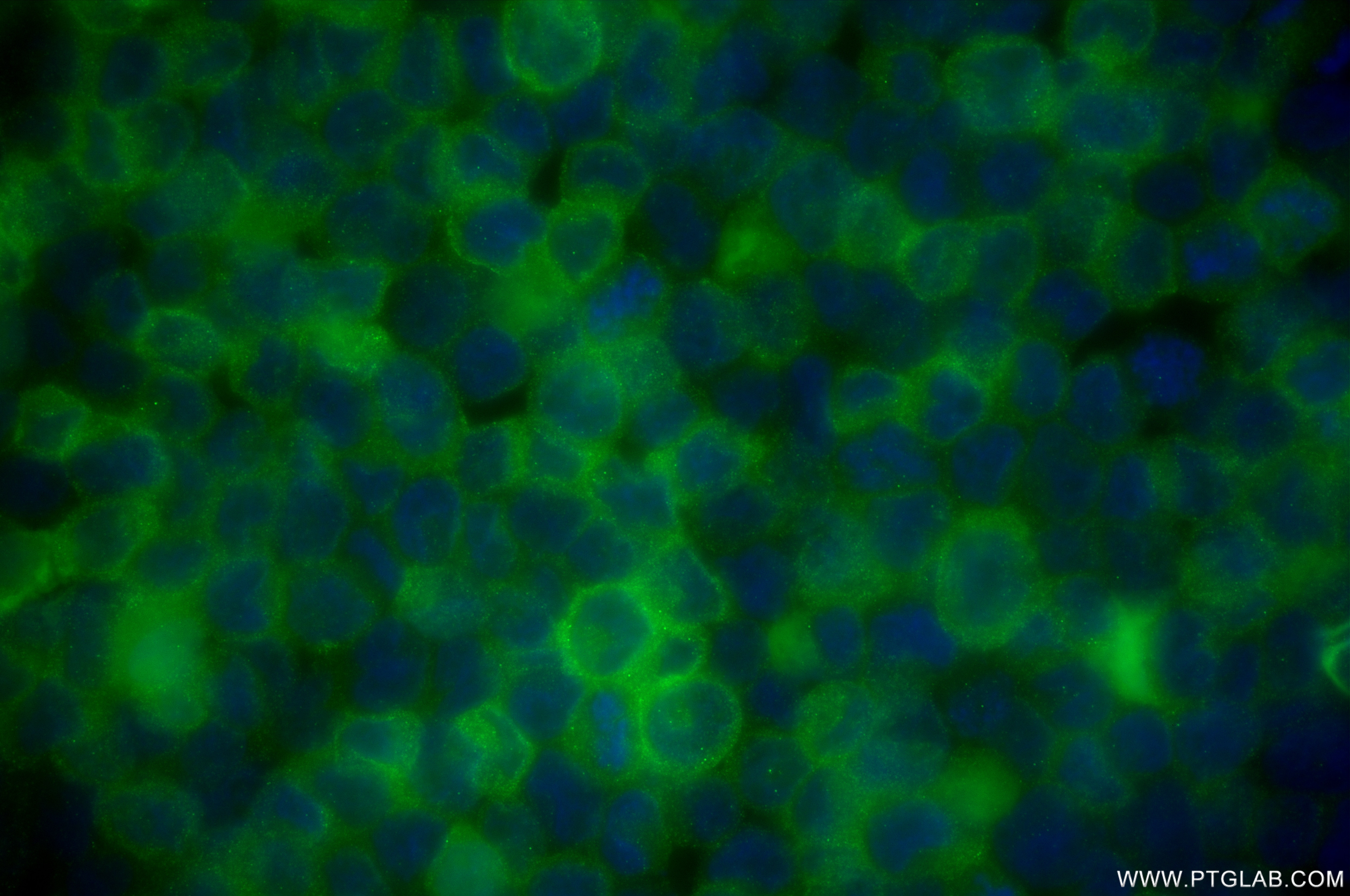 Immunofluorescence (IF) / fluorescent staining of HEL cells using EPB42 Recombinant antibody (84921-3-RR)