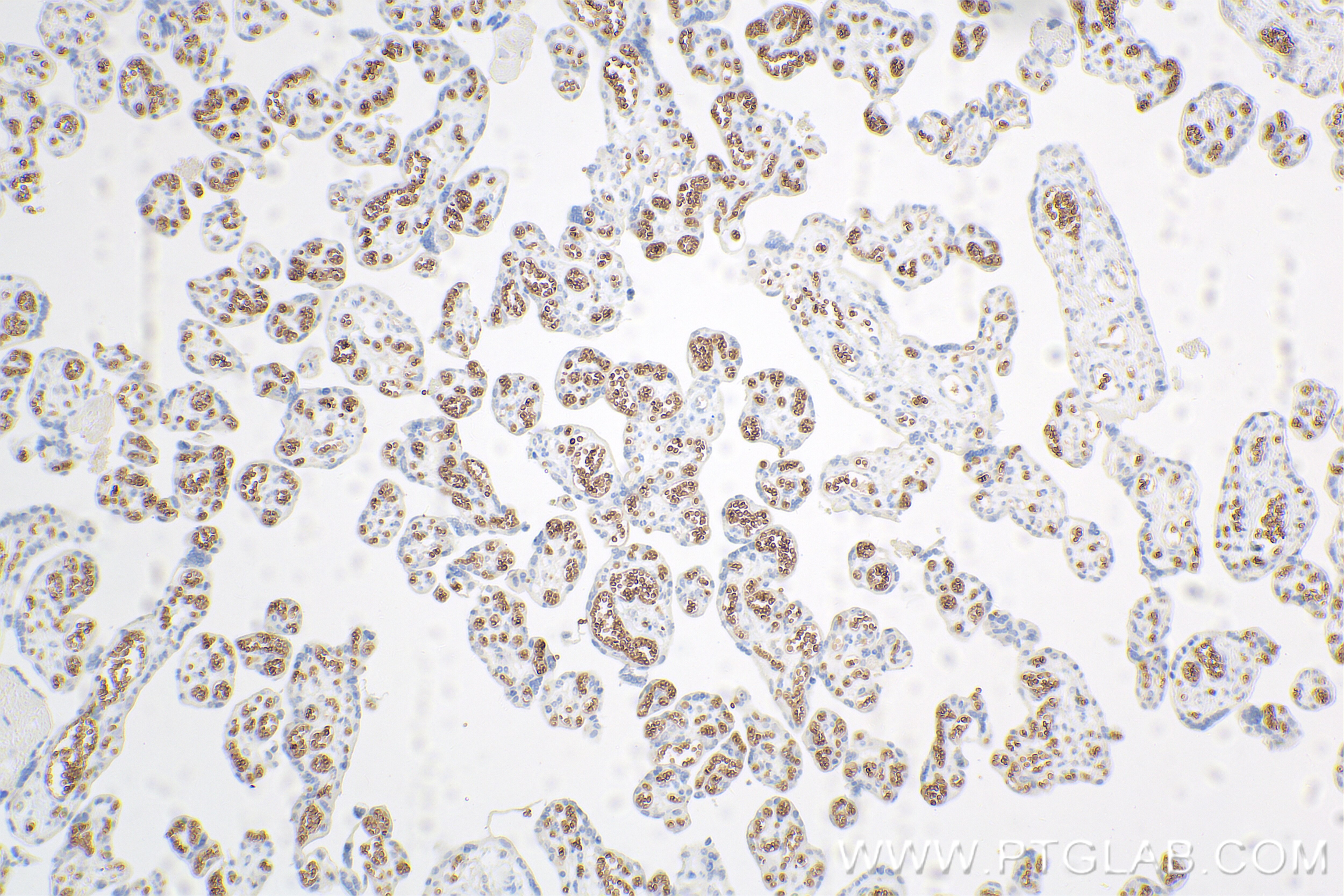 Immunohistochemistry (IHC) staining of human placenta tissue using EPB42 Recombinant antibody (84921-3-RR)