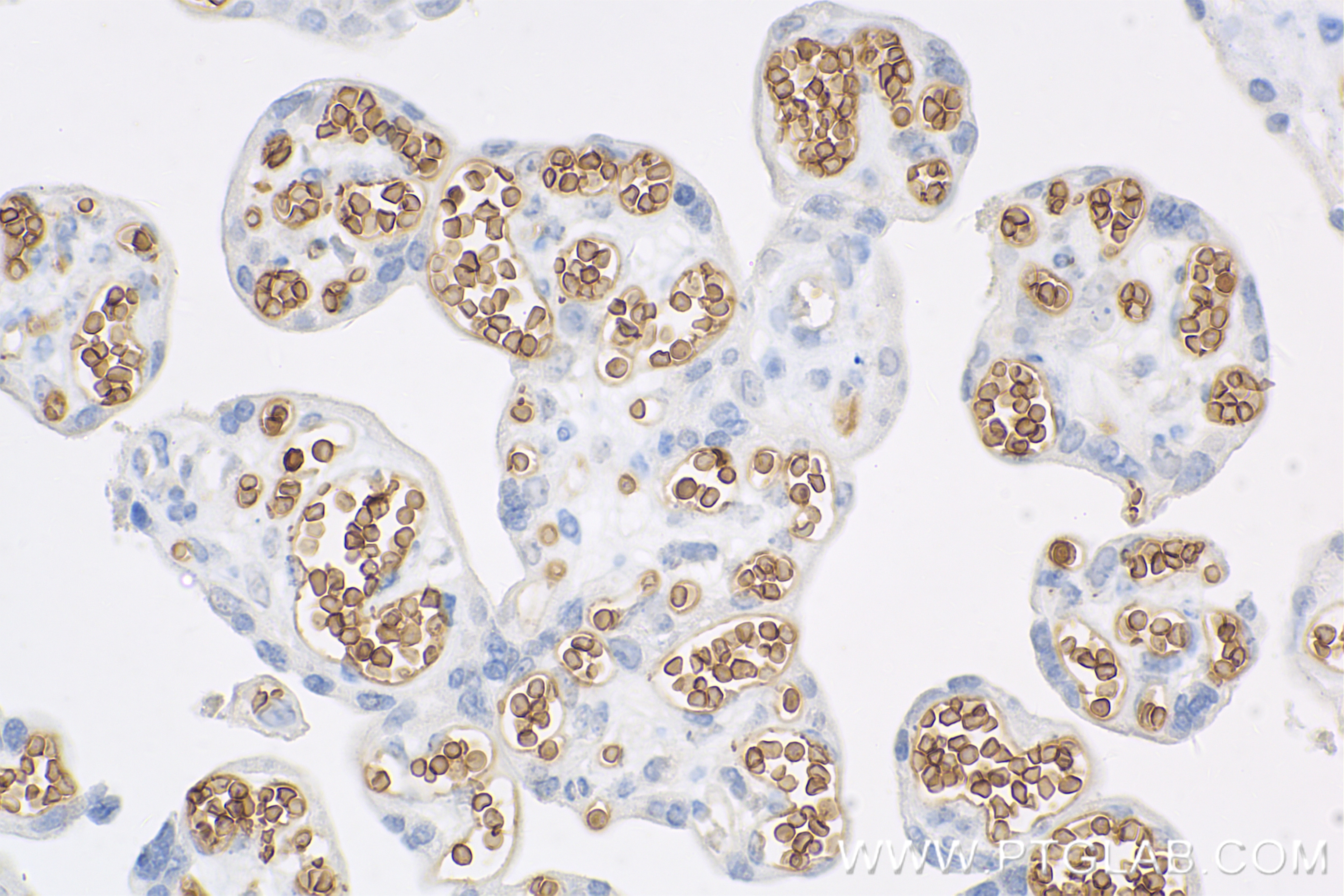 Immunohistochemistry (IHC) staining of human placenta tissue using EPB42 Recombinant antibody (84921-3-RR)