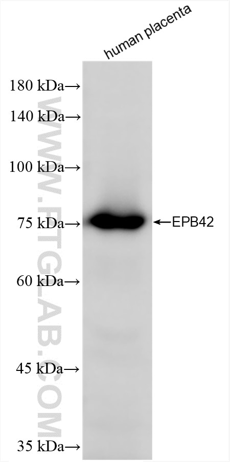 Western Blot (WB) analysis of human placenta tissue using EPB42 Recombinant antibody (84921-3-RR)