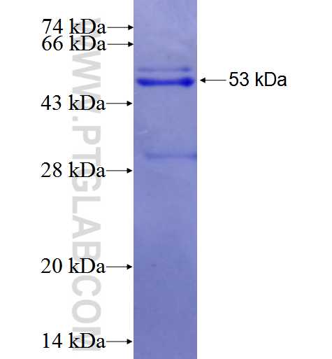 EPB42 fusion protein Ag23556 SDS-PAGE