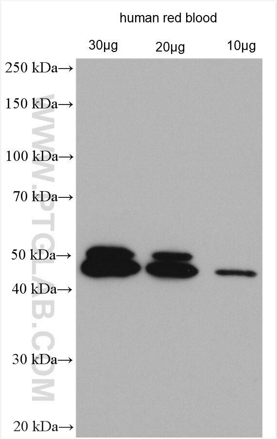 Western Blot (WB) analysis of various lysates using Dematin Polyclonal antibody (16808-1-AP)